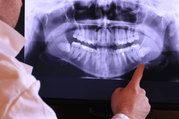 Best Mobile Emergency Dentist in Amerin Nyon, CA