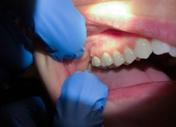Best Orthodontic Emergency Dentist in Amerin Nyon, CA